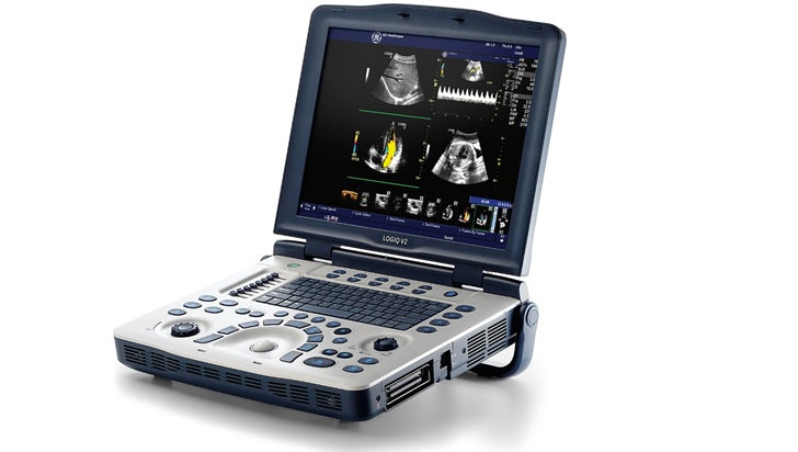 GE LOGIQ V1 Ultrasound System