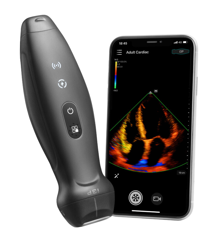 Mindray TE Air: Wireless Handheld Ultrasound