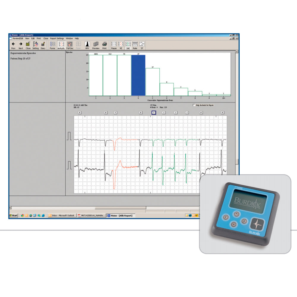 Burdick/Mortara Vision Holter Software