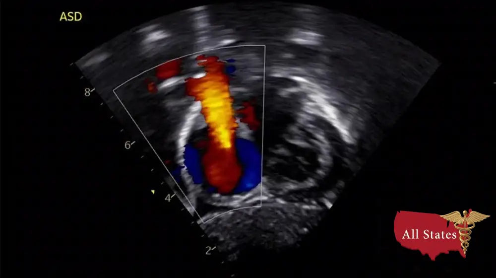 GE VIVID IQ Refurbished with 2 Probes