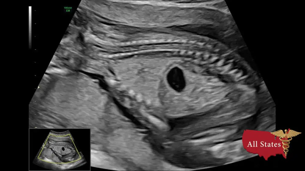 GE VOLUSON E8 Refurbished WITH 3 Probes