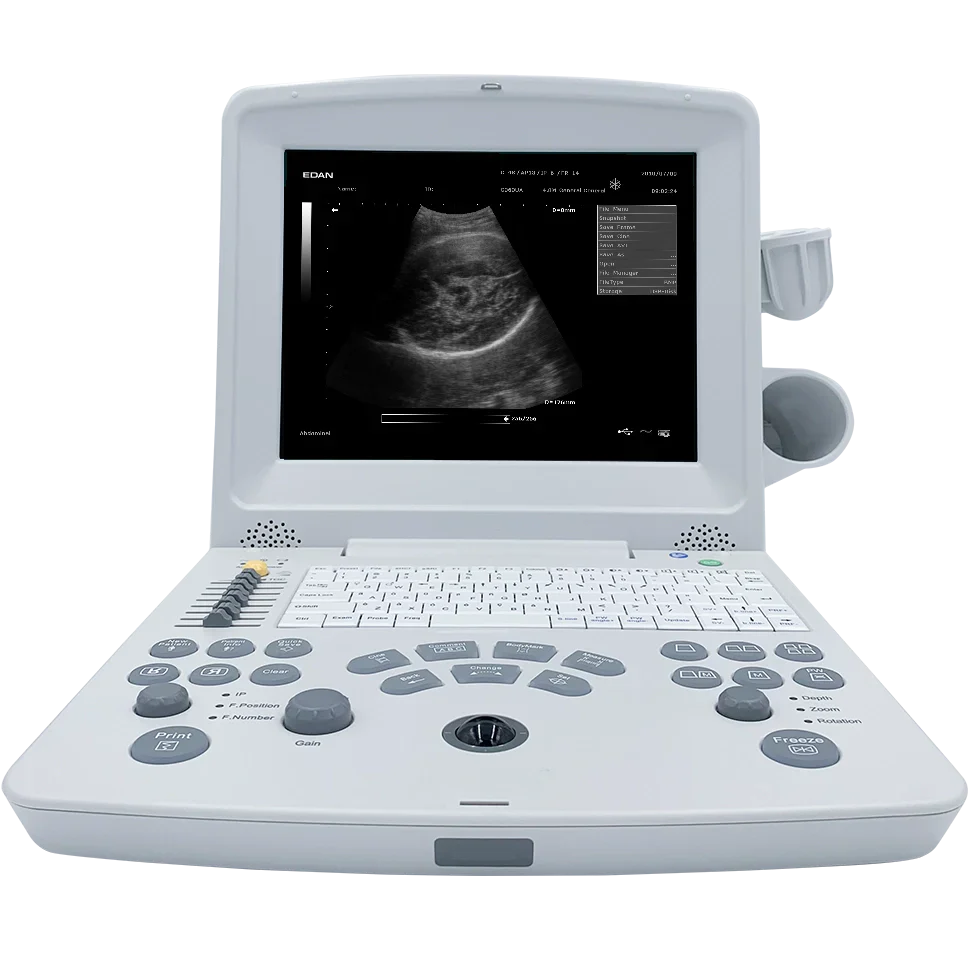 Edan DUS60 Ultrasound