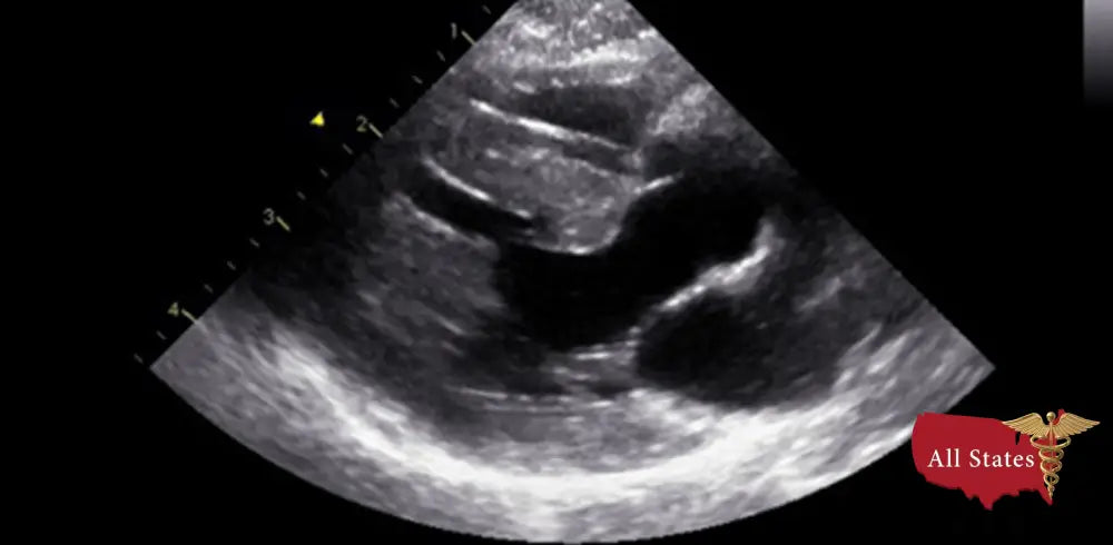 GE Vivid E9 XDClear Refurbished with 3 Probes