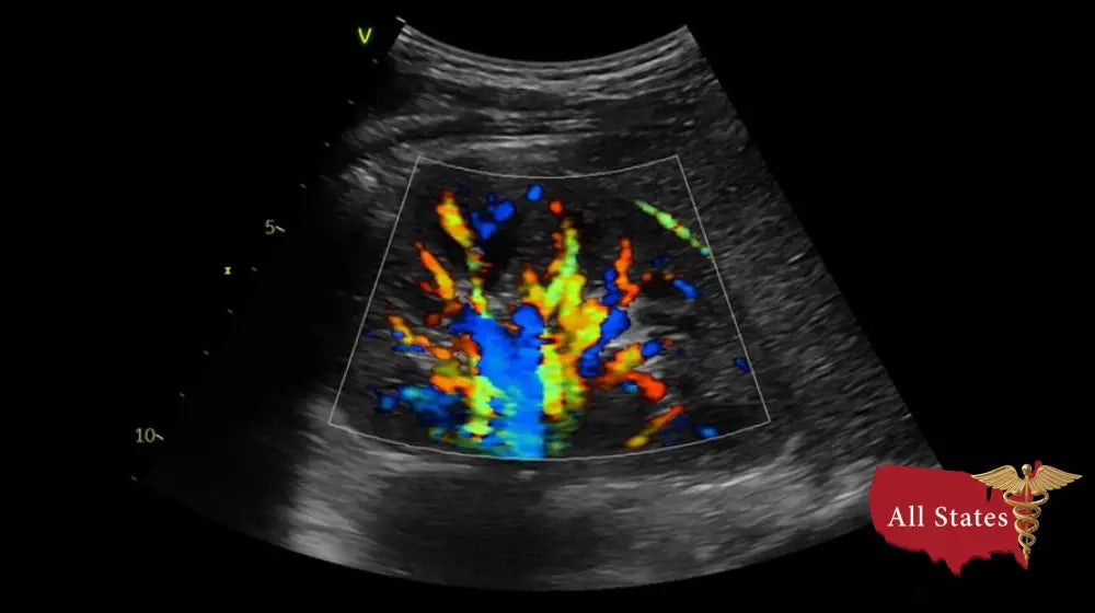 GE VIVID IQ Refurbished with 2 Probes