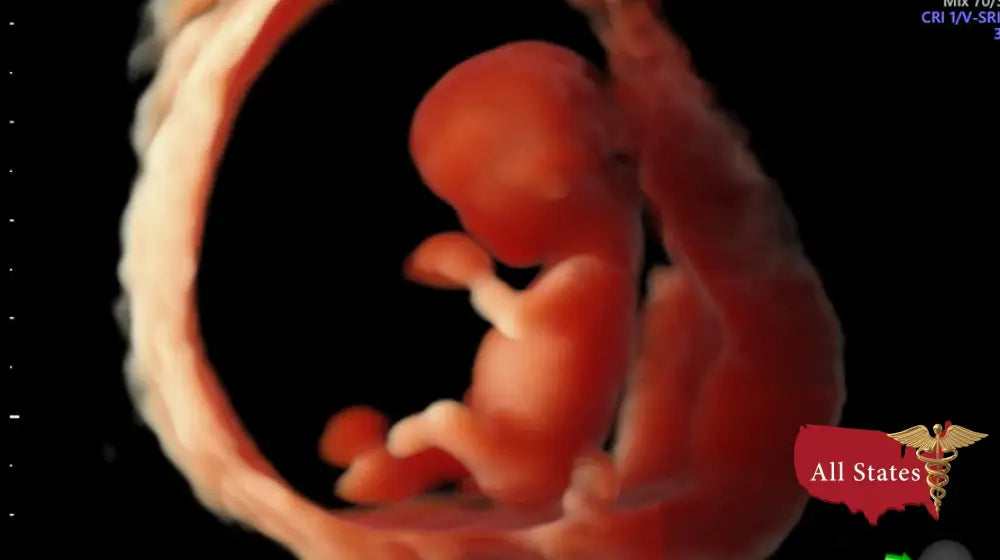 GE VOLUSON E8 Refurbished WITH 3 Probes