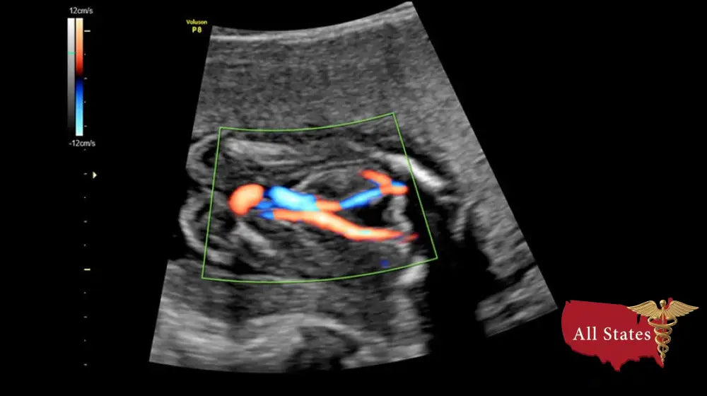 GE VOLUSON P8 BT16 Refurbished WITH 3 Probes