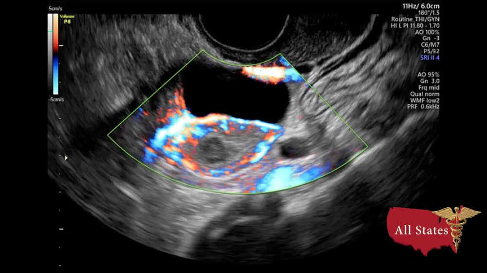 GE VOLUSON P8 BT16 Refurbished WITH 3 Probes
