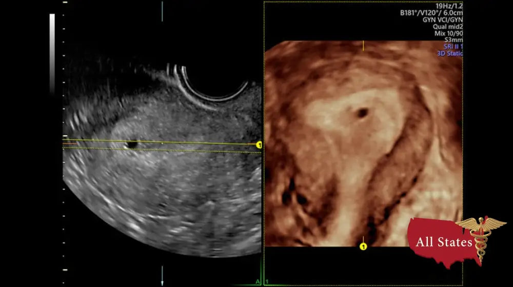 GE VOLUSON P8 BT16 Refurbished WITH 3 Probes