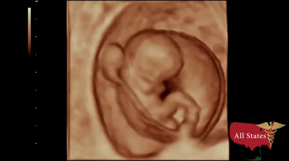 GE VOLUSON P8 BT16 Refurbished WITH 3 Probes