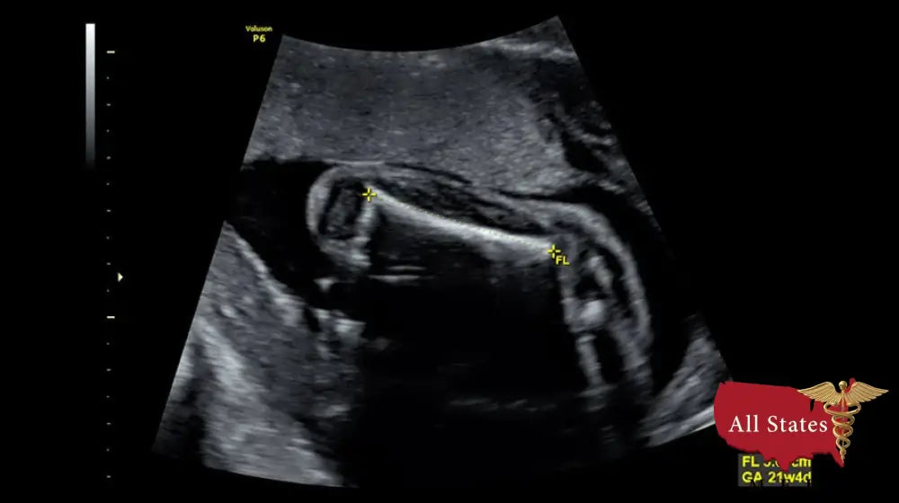 GE VOLUSON P8 BT22 Brand New